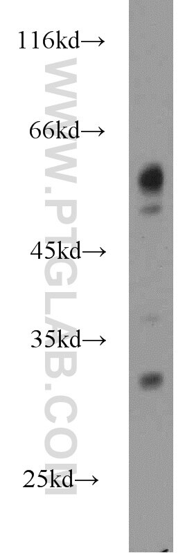 Western Blot (WB) analysis of mouse uterus tissue using MIER3 Polyclonal antibody (17543-1-AP)