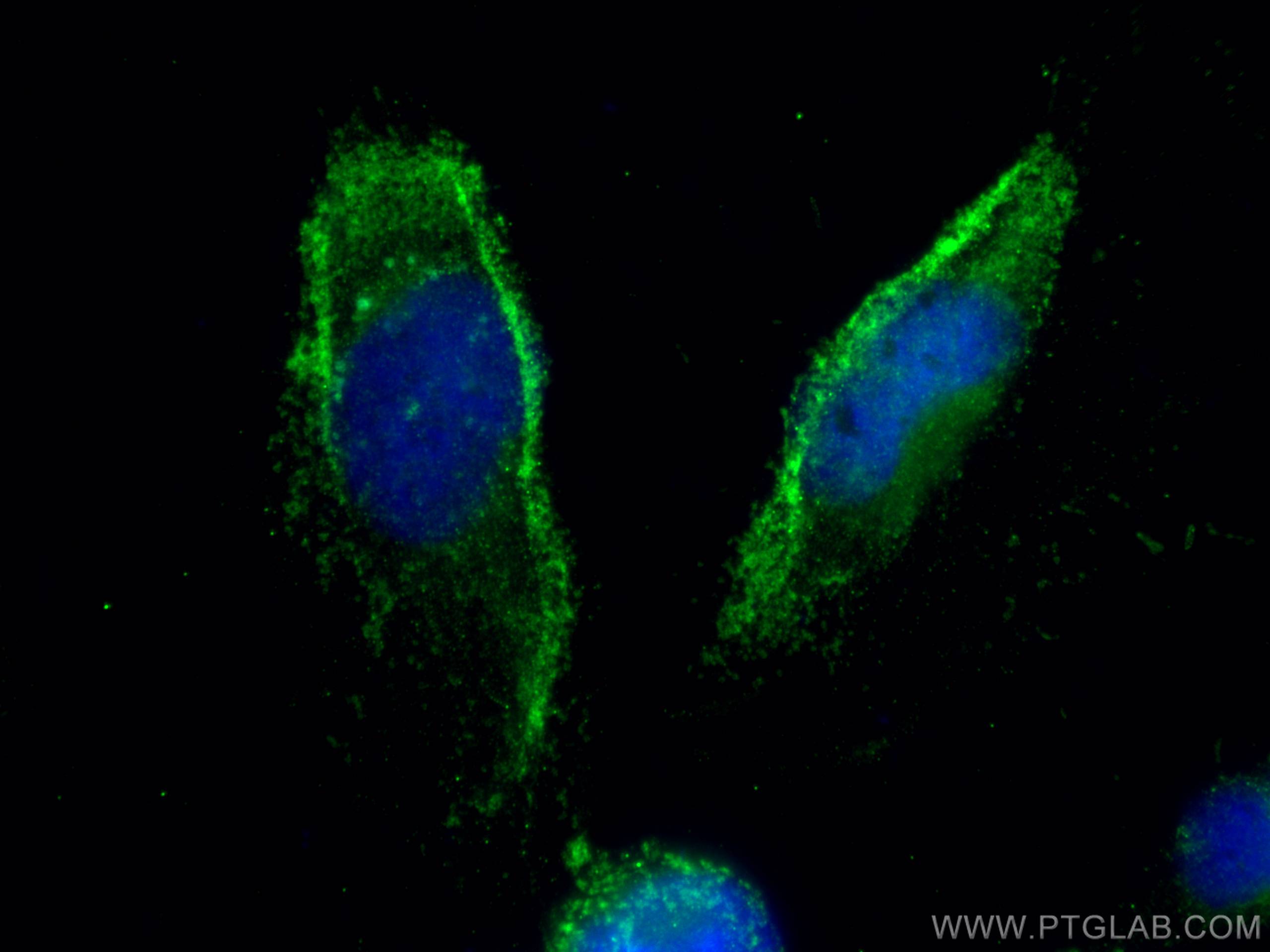 Immunofluorescence (IF) / fluorescent staining of U-251 cells using MIF Polyclonal antibody (20415-1-AP)