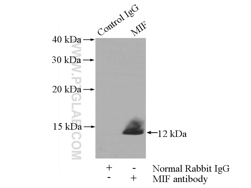 Immunoprecipitation (IP) experiment of mouse spleen tissue using MIF Polyclonal antibody (20415-1-AP)