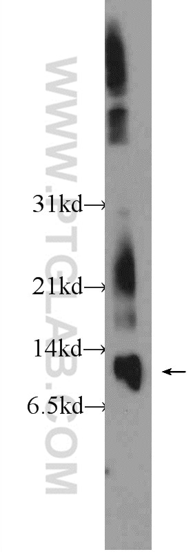 Western Blot (WB) analysis of rat spleen tissue using MIF Polyclonal antibody (20415-1-AP)