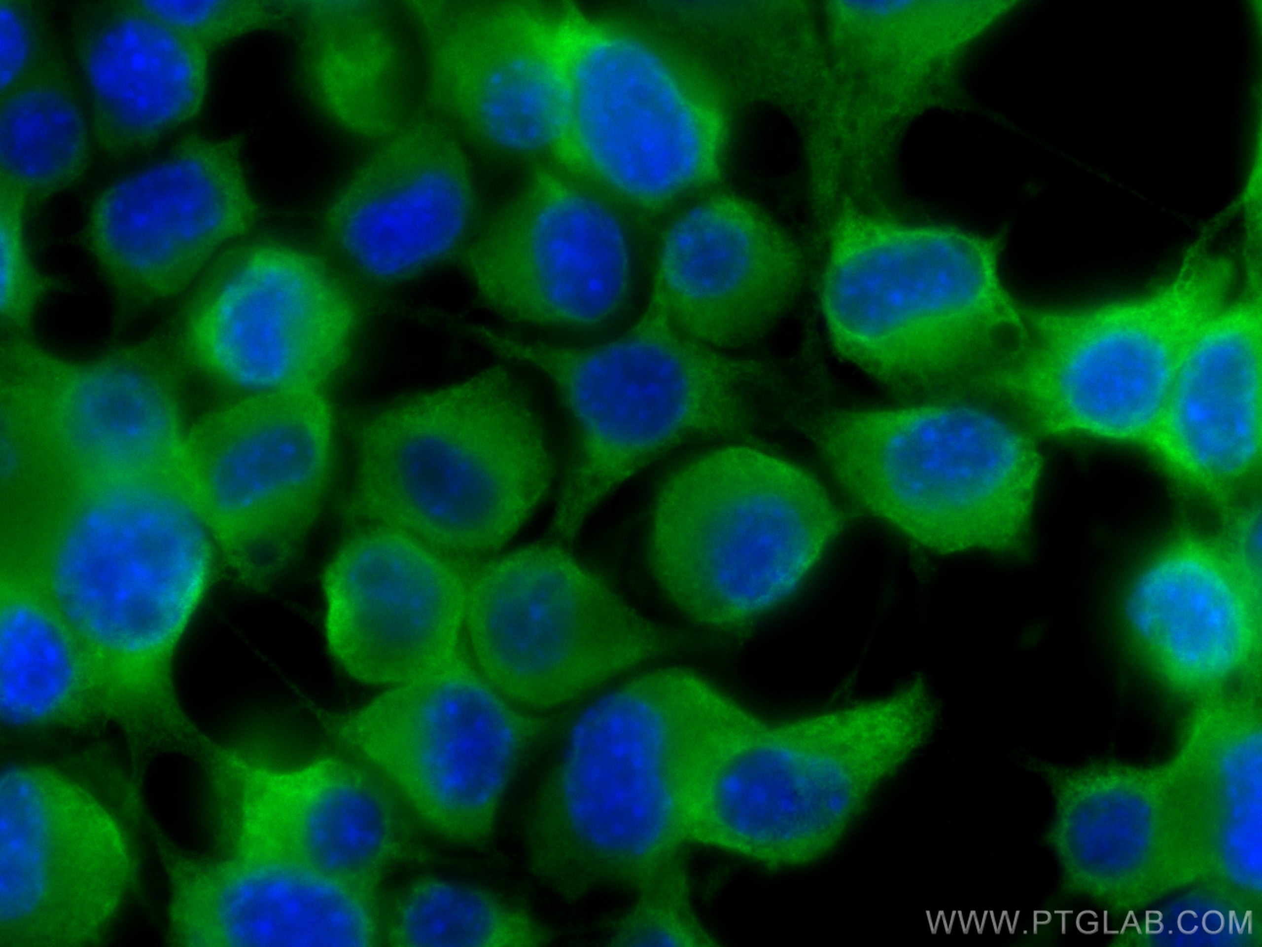 Immunofluorescence (IF) / fluorescent staining of Neuro-2a cells using MIF Polyclonal antibody (30957-1-AP)