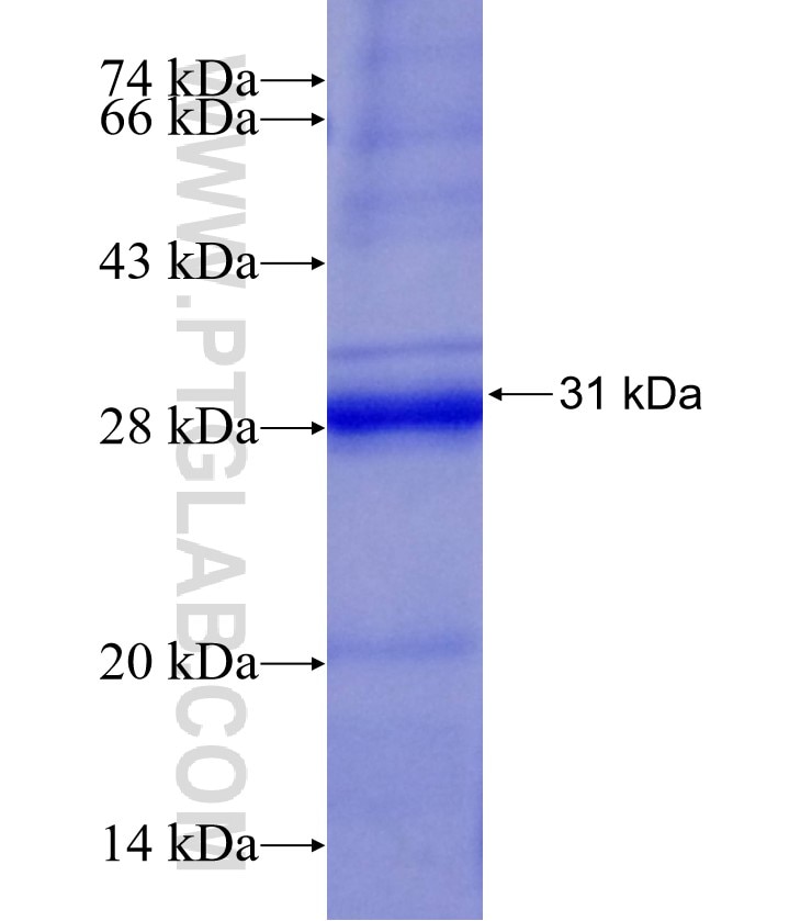 MIF fusion protein Ag14058 SDS-PAGE