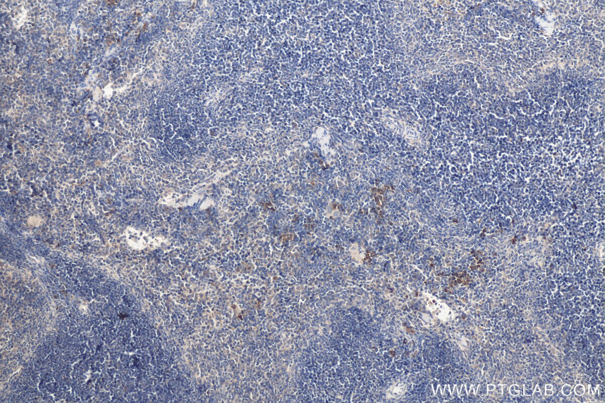 Immunohistochemistry (IHC) staining of mouse spleen tissue using MIG Polyclonal antibody (22355-1-AP)