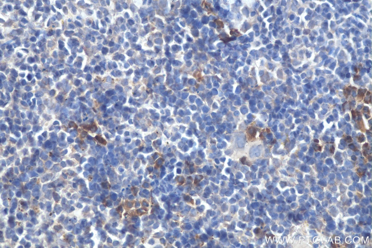 Immunohistochemistry (IHC) staining of mouse spleen tissue using MIG Polyclonal antibody (22355-1-AP)