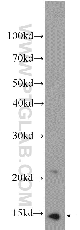 MIG
