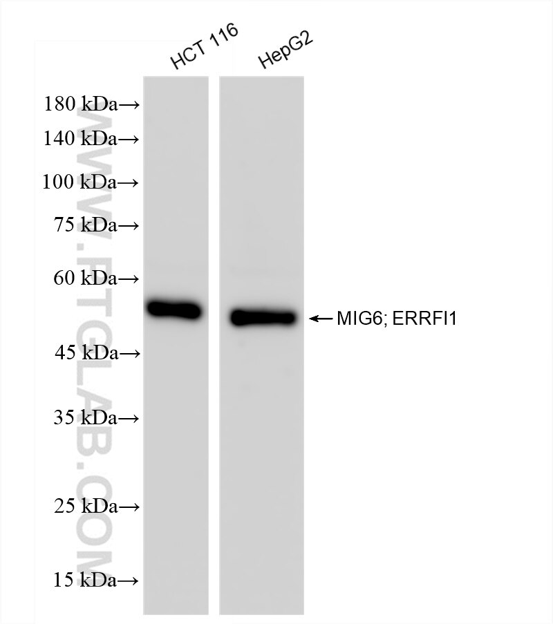 Western Blot (WB) analysis of various lysates using MIG6; ERRFI1 Recombinant antibody (83475-2-RR)