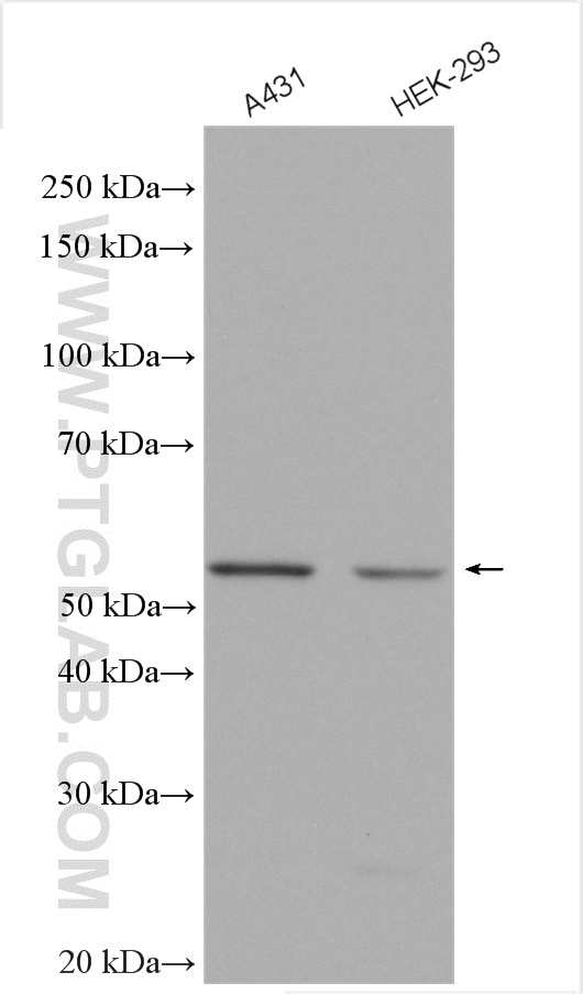 Western Blot (WB) analysis of various lysates using MINA Polyclonal antibody (12214-1-AP)
