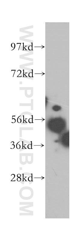 WB analysis of mouse liver using 12214-1-AP