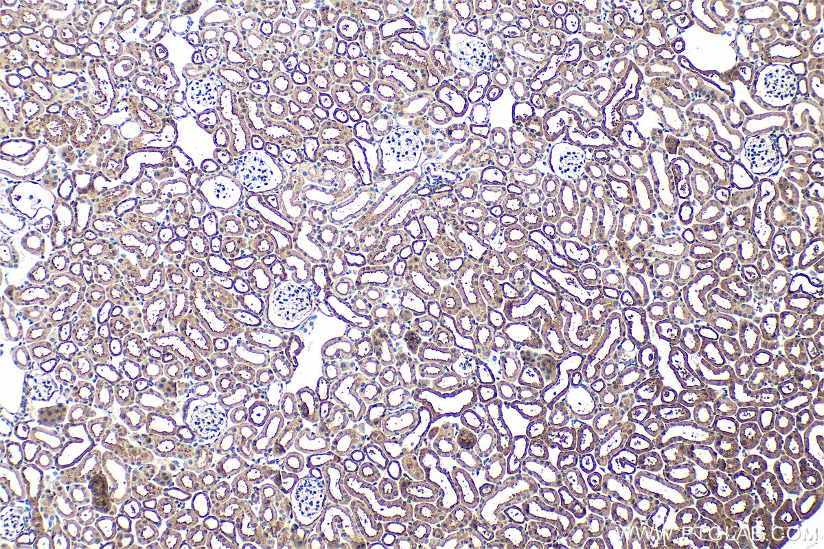 Immunohistochemistry (IHC) staining of mouse kidney tissue using MINDY3 Polyclonal antibody (26478-1-AP)