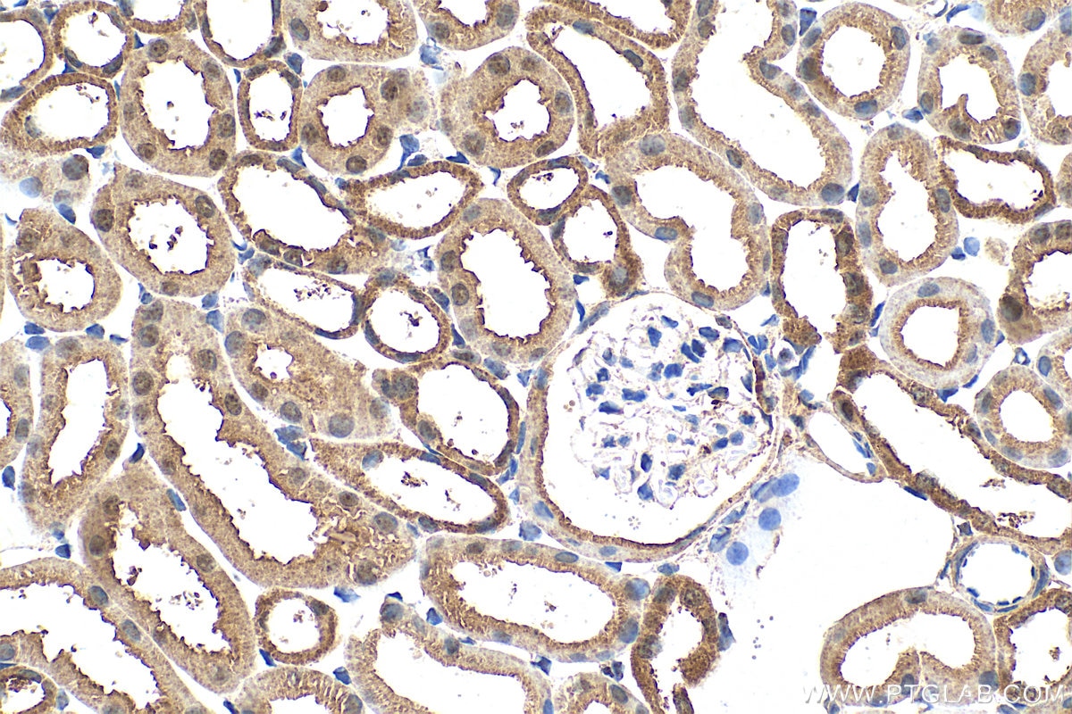 Immunohistochemistry (IHC) staining of mouse kidney tissue using MINDY3 Polyclonal antibody (26478-1-AP)