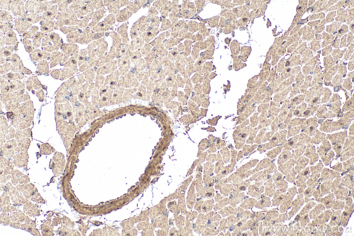 Immunohistochemistry (IHC) staining of rat heart tissue using MINDY3 Polyclonal antibody (26478-1-AP)