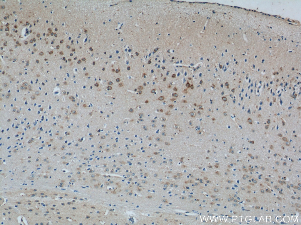 Immunohistochemistry (IHC) staining of mouse brain tissue using MINK1 Polyclonal antibody (13137-1-AP)