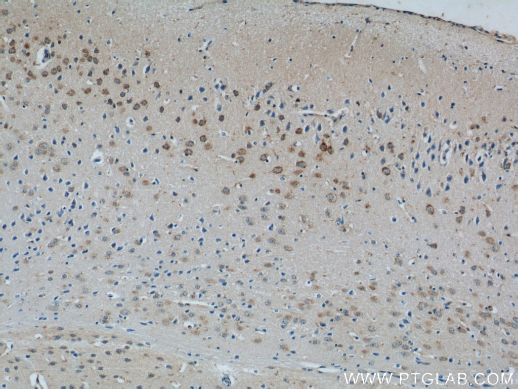 Immunohistochemistry (IHC) staining of mouse brain tissue using MINK1 Polyclonal antibody (13137-1-AP)