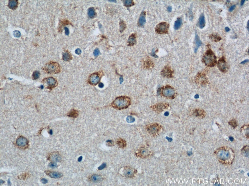 Immunohistochemistry (IHC) staining of mouse brain tissue using MINK1 Polyclonal antibody (13137-1-AP)