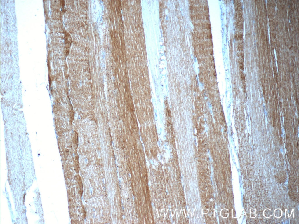 Immunohistochemistry (IHC) staining of human skeletal muscle tissue using MINK1 Polyclonal antibody (13137-1-AP)