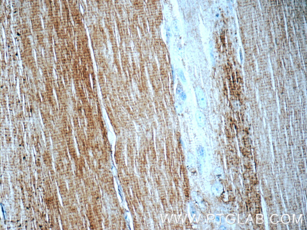 Immunohistochemistry (IHC) staining of human skeletal muscle tissue using MINK1 Polyclonal antibody (13137-1-AP)