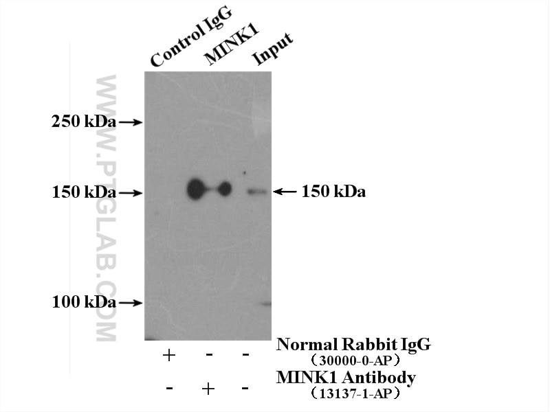 Immunoprecipitation (IP) experiment of mouse brain tissue using MINK1 Polyclonal antibody (13137-1-AP)