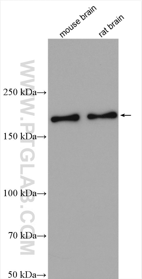 Western Blot (WB) analysis of various lysates using MINK1 Polyclonal antibody (13137-1-AP)