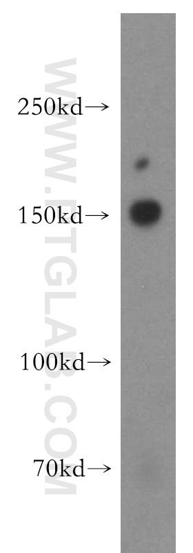 Western Blot (WB) analysis of mouse brain tissue using MINK1 Polyclonal antibody (13137-1-AP)