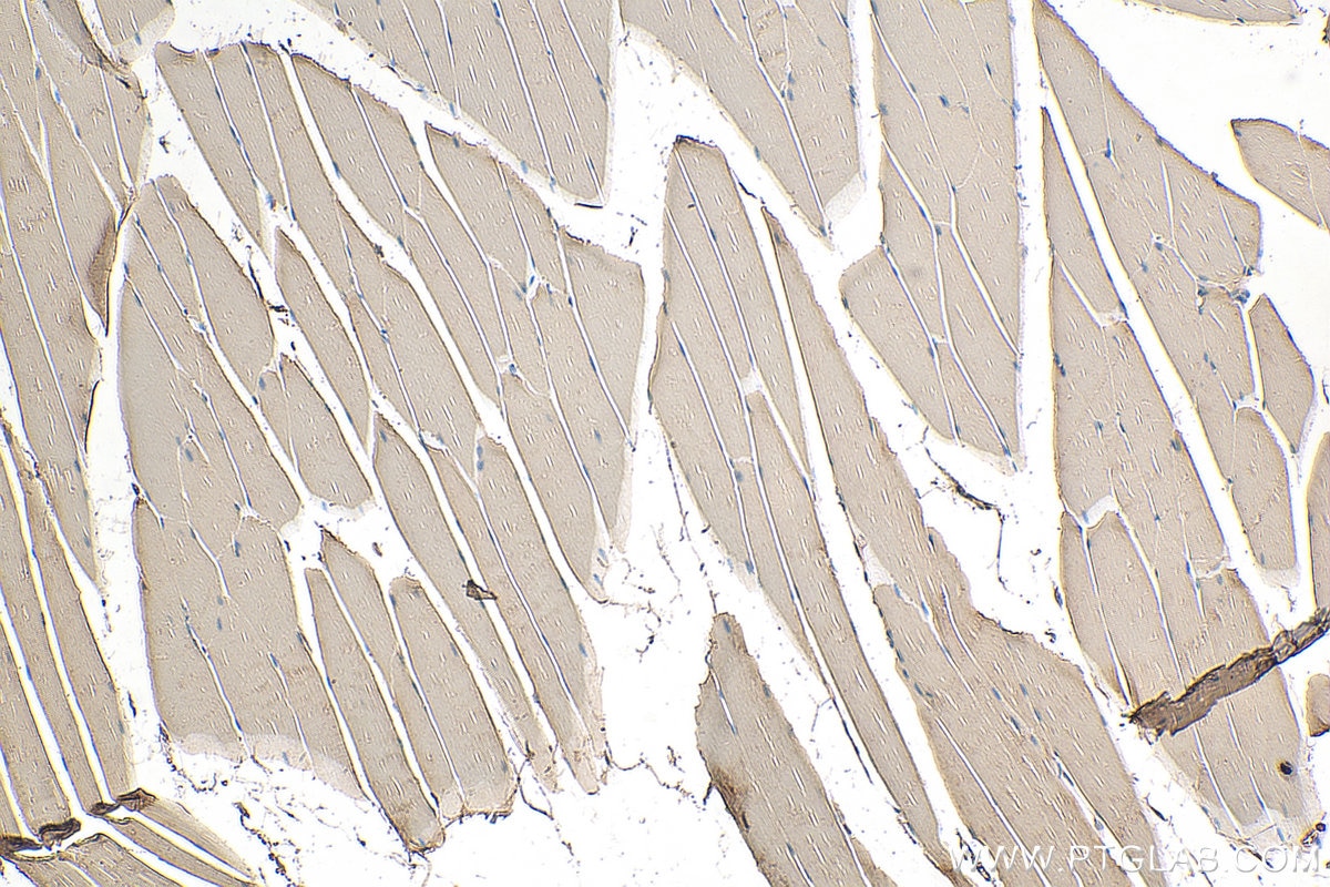 IHC staining of mouse skeletal muscle using 20826-1-AP