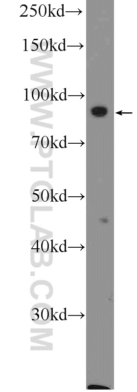 WB analysis of HeLa using 20826-1-AP