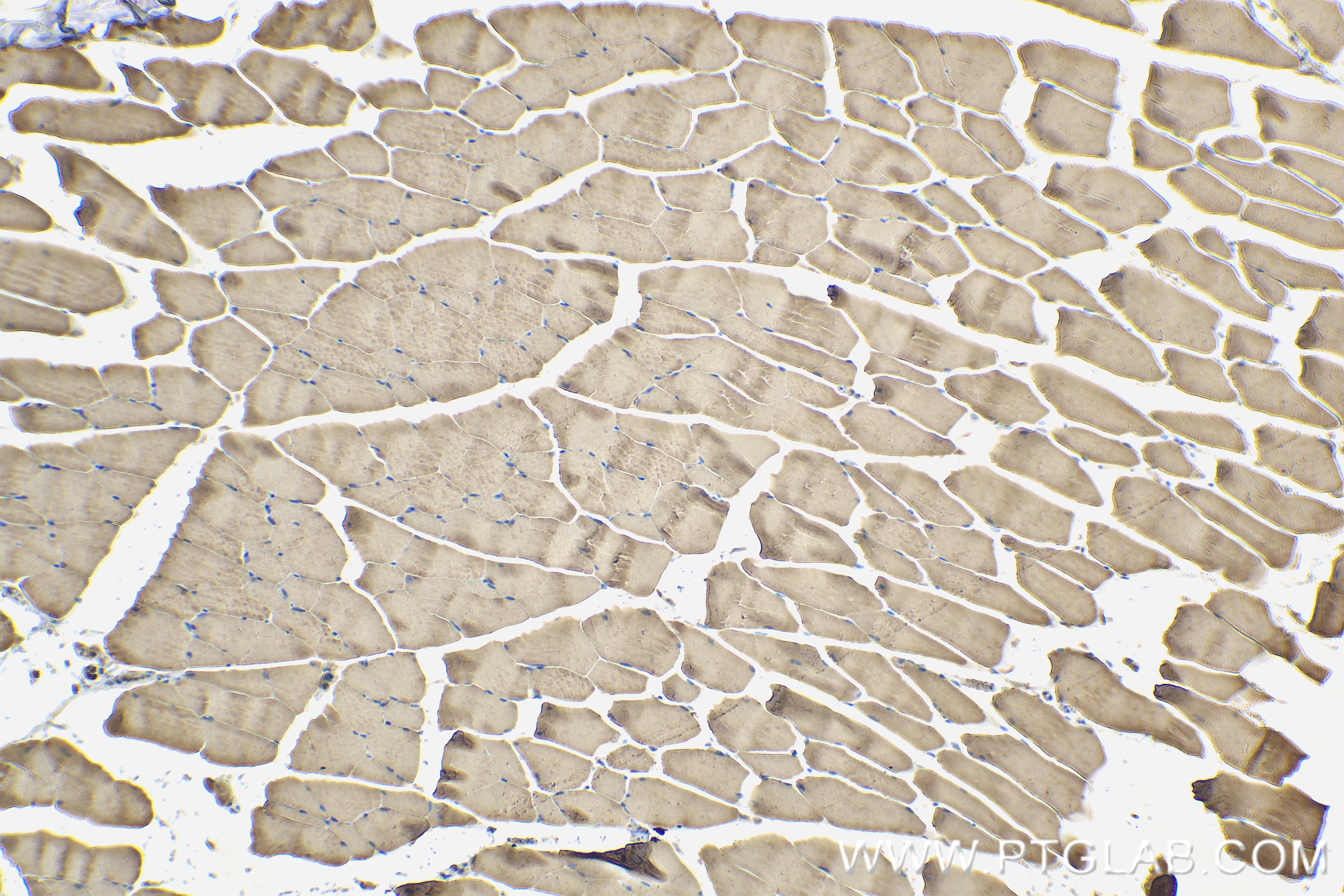 Immunohistochemical analysis of paraffin-embedded mouse skeletal muscle tissue slide using 83856-4-RR (MIOS antibody) at dilution of 1:400 (under 10x lens). Heat mediated antigen retrieval with Tris-EDTA buffer (pH 9.0). Immunohistochemistry (IHC) staining of mouse skeletal muscle tissue using MIOS Recombinant monoclonal antibody (83856-4-RR)