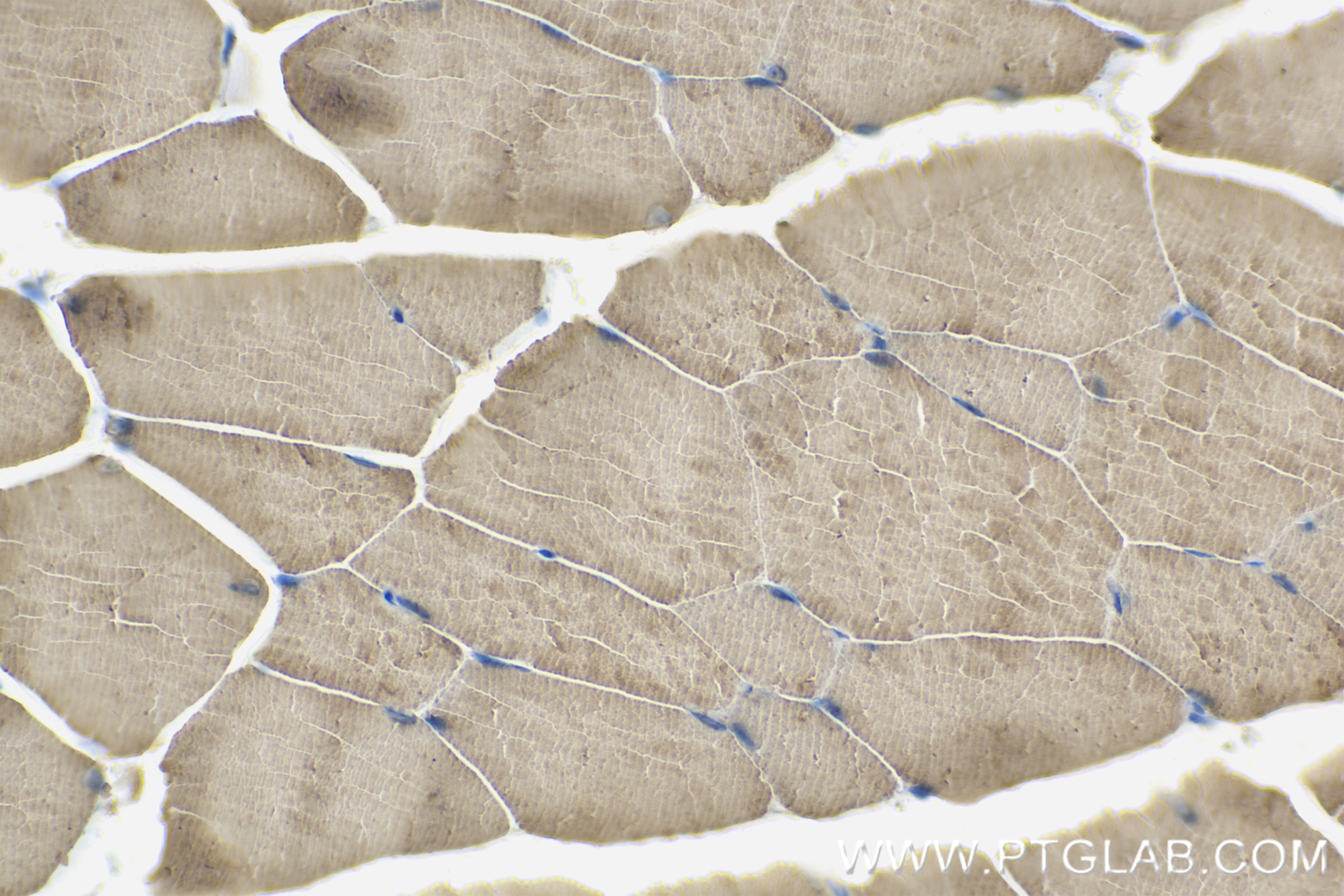 Immunohistochemical analysis of paraffin-embedded mouse skeletal muscle tissue slide using 83856-4-RR (MIOS antibody) at dilution of 1:400 (under 40x lens). Heat mediated antigen retrieval with Tris-EDTA buffer (pH 9.0). Immunohistochemistry (IHC) staining of mouse skeletal muscle tissue using MIOS Recombinant monoclonal antibody (83856-4-RR)