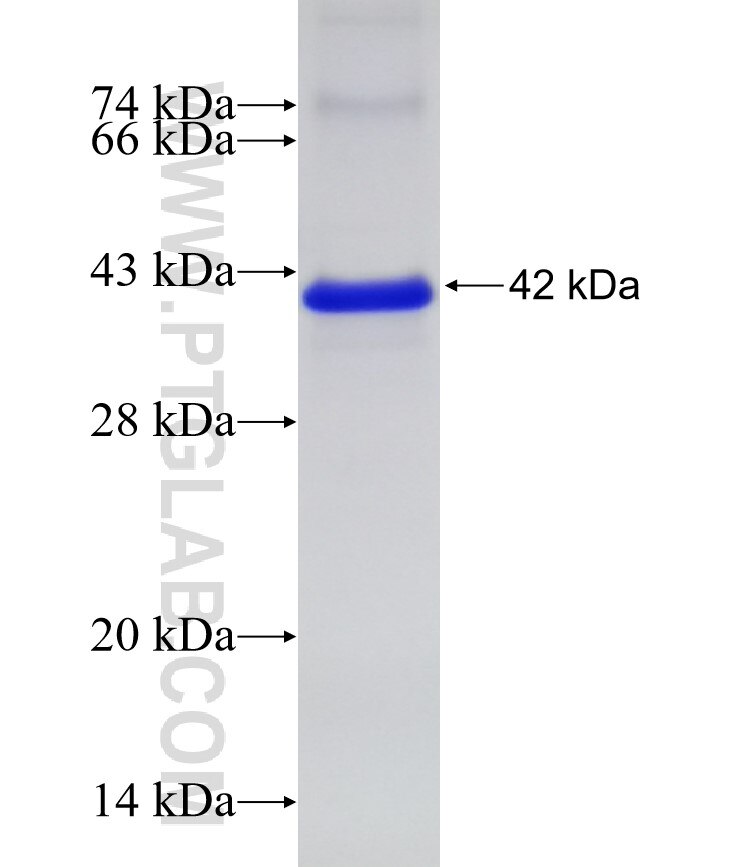 MIOS fusion protein Ag15148 SDS-PAGE