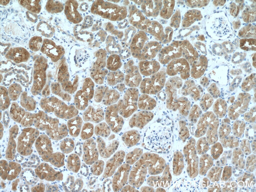 Immunohistochemistry (IHC) staining of human kidney tissue using MIOX Polyclonal antibody (17623-1-AP)