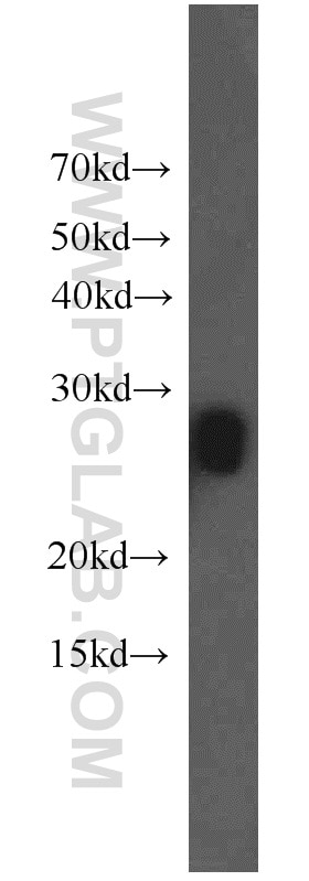 Western Blot (WB) analysis of mouse eye tissue using MIP Polyclonal antibody (17977-1-AP)