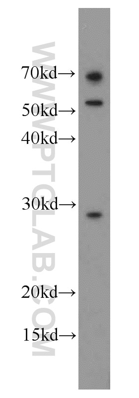 Western Blot (WB) analysis of mouse skeletal muscle tissue using MIP Polyclonal antibody (17977-1-AP)