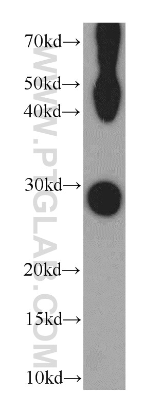 Western Blot (WB) analysis of mouse eye tissue using MIP Polyclonal antibody (17977-1-AP)