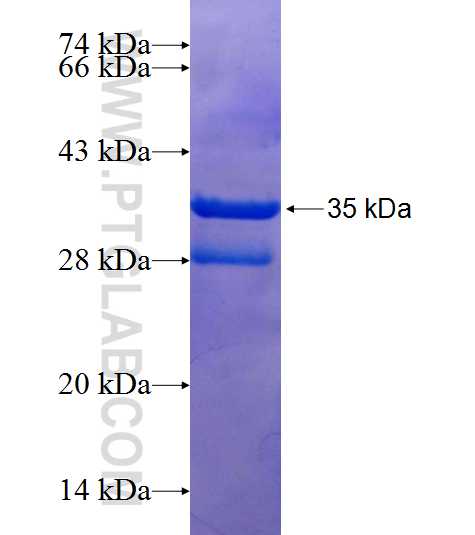 MIP fusion protein Ag12369 SDS-PAGE