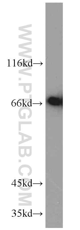 Western Blot (WB) analysis of HepG2 cells using MIPEP Polyclonal antibody (11002-1-AP)