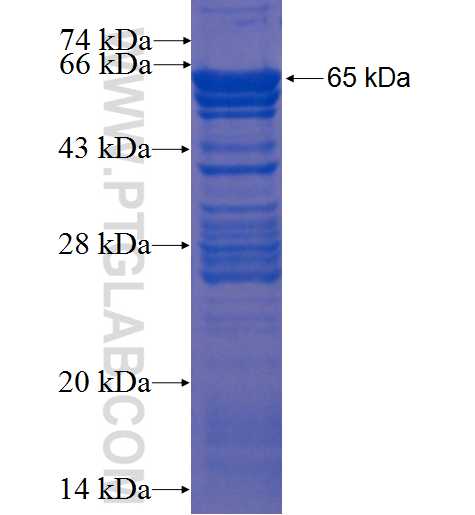 MIPEP fusion protein Ag1451 SDS-PAGE