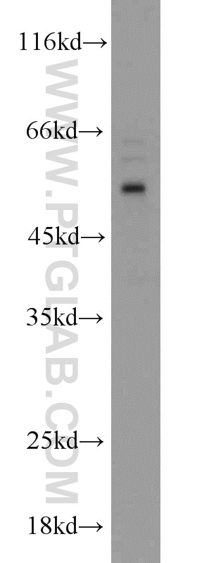 Western Blot (WB) analysis of HepG2 cells using MIPOL1 Polyclonal antibody (14158-1-AP)