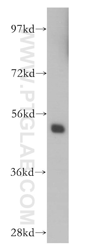 Western Blot (WB) analysis of human liver tissue using MIPOL1 Polyclonal antibody (14158-1-AP)