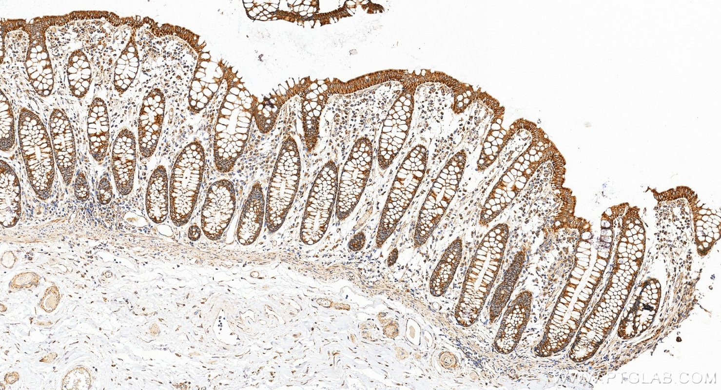Immunohistochemistry (IHC) staining of human colon tissue using MIRO2 Recombinant monoclonal antibody (88330-1-RR)