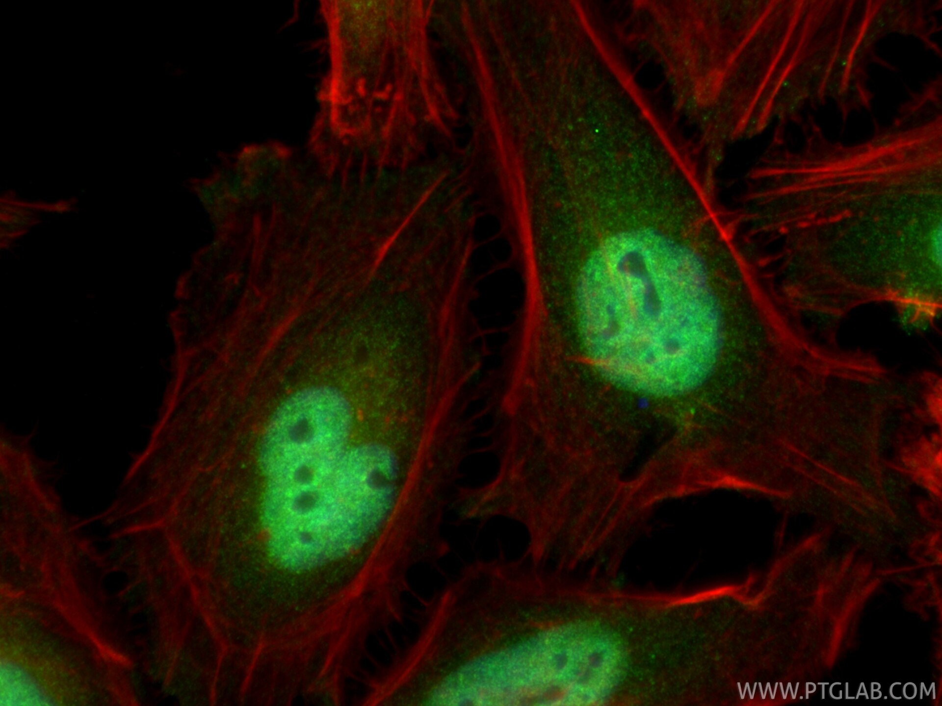 Immunofluorescence (IF) / fluorescent staining of HeLa cells using MIS12 Polyclonal antibody (19820-1-AP)