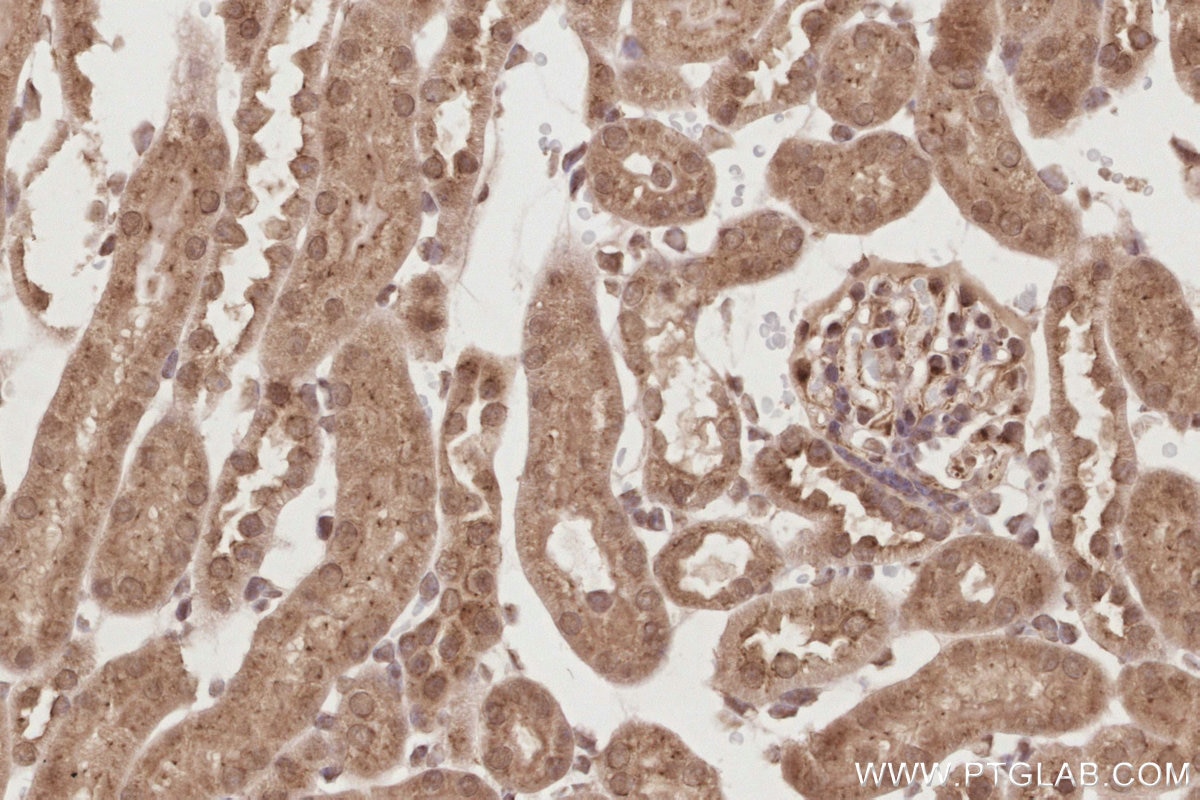 IHC staining of mouse kidney using 19820-1-AP Immunohistochemistry (IHC) staining of mouse kidney tissue using MIS12 Polyclonal antibody (19820-1-AP)
