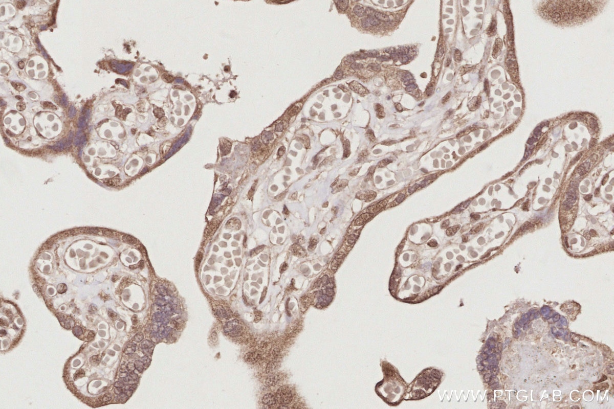 IHC staining of human placenta using 19820-1-AP Immunohistochemistry (IHC) staining of human placenta tissue using MIS12 Polyclonal antibody (19820-1-AP)