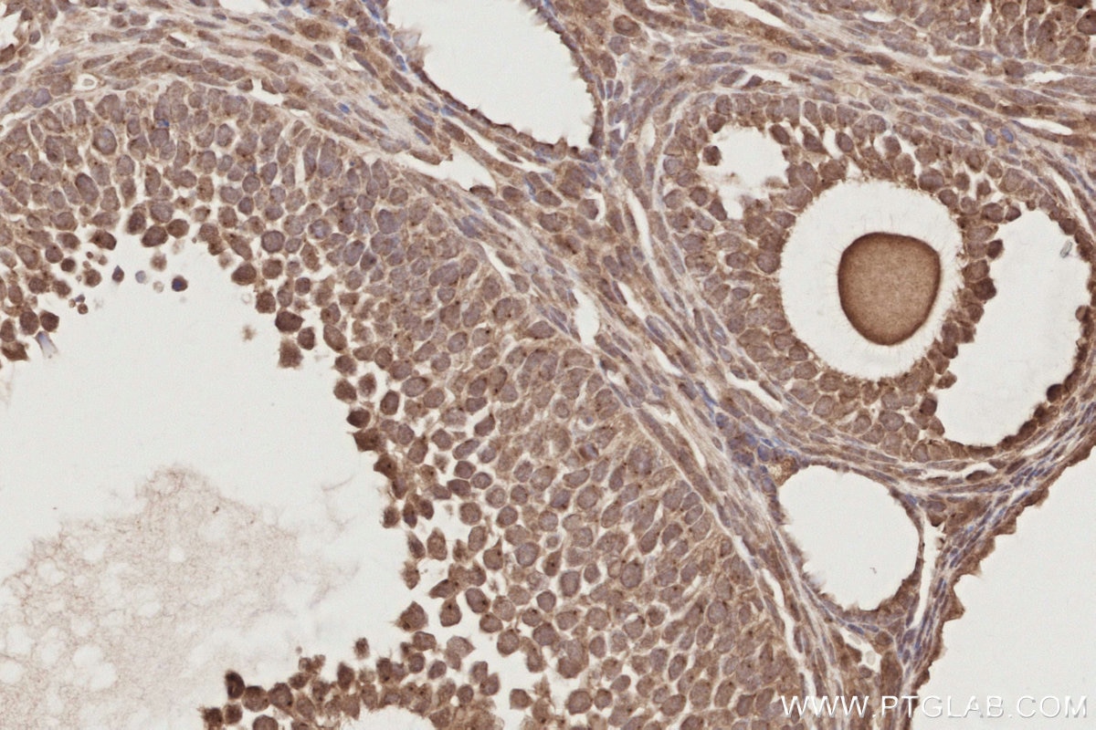 IHC staining of mouse ovary using 19820-1-AP Immunohistochemistry (IHC) staining of mouse ovary tissue using MIS12 Polyclonal antibody (19820-1-AP)
