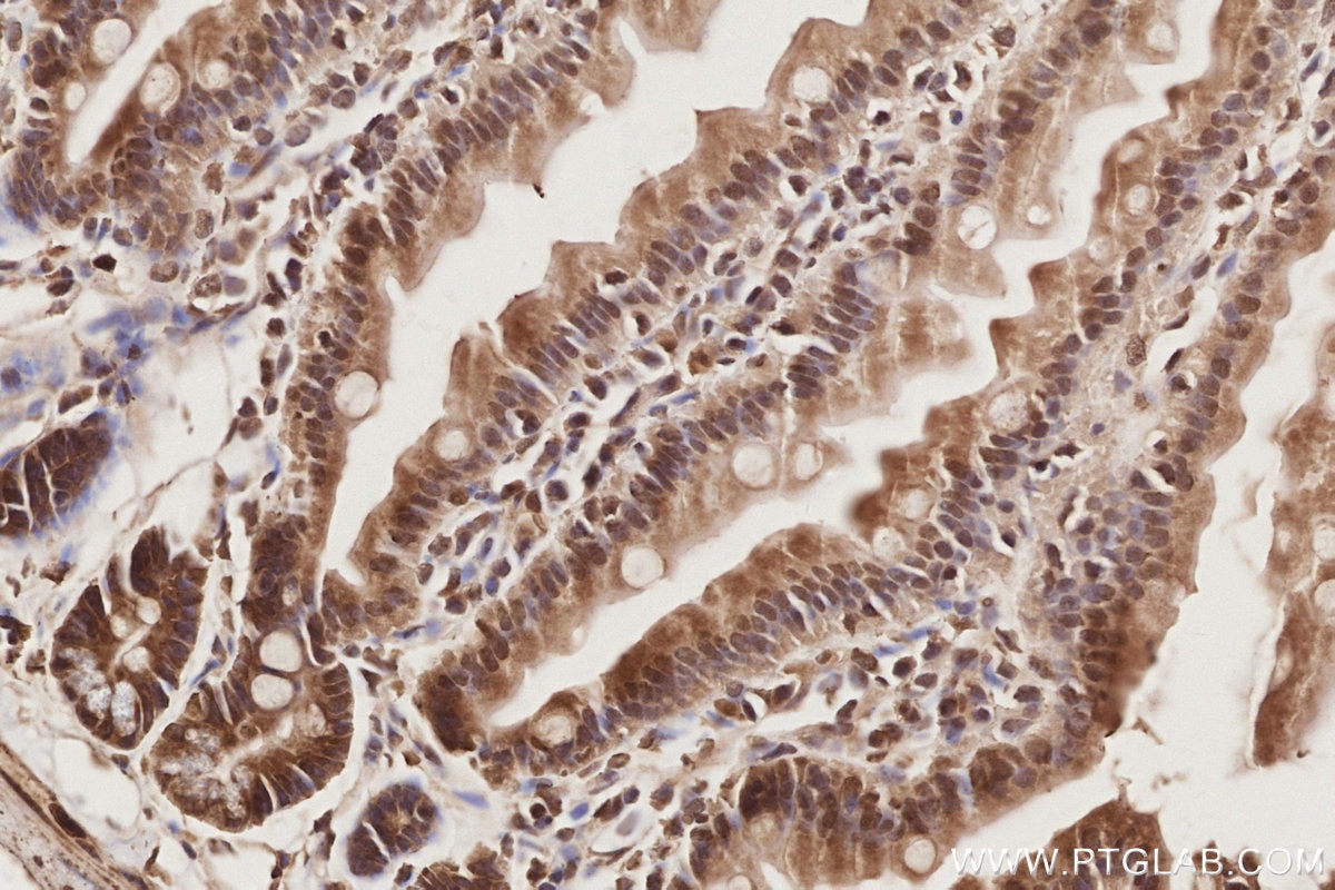 IHC staining of mouse small intestine using 19820-1-AP Immunohistochemistry (IHC) staining of mouse small intestine tissue using MIS12 Polyclonal antibody (19820-1-AP)