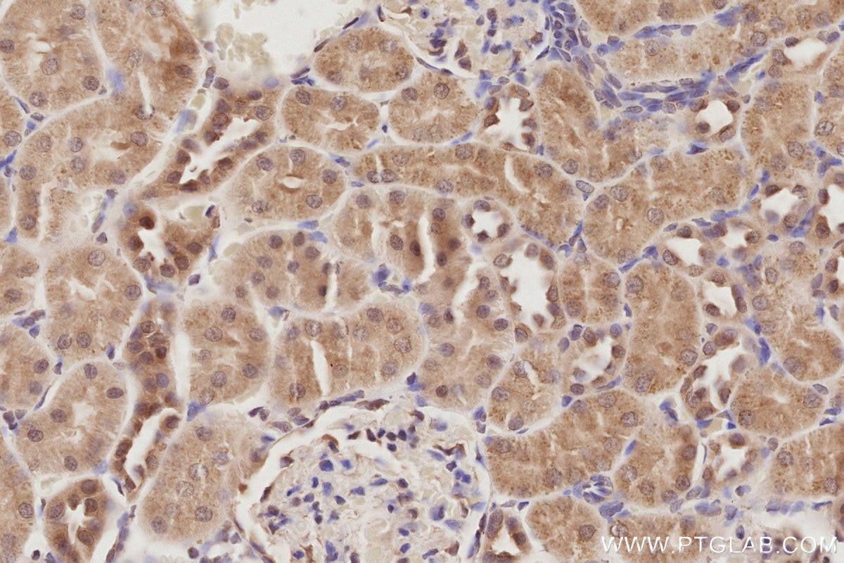 IHC staining of rat kidney using 19820-1-AP Immunohistochemistry (IHC) staining of rat kidney tissue using MIS12 Polyclonal antibody (19820-1-AP)