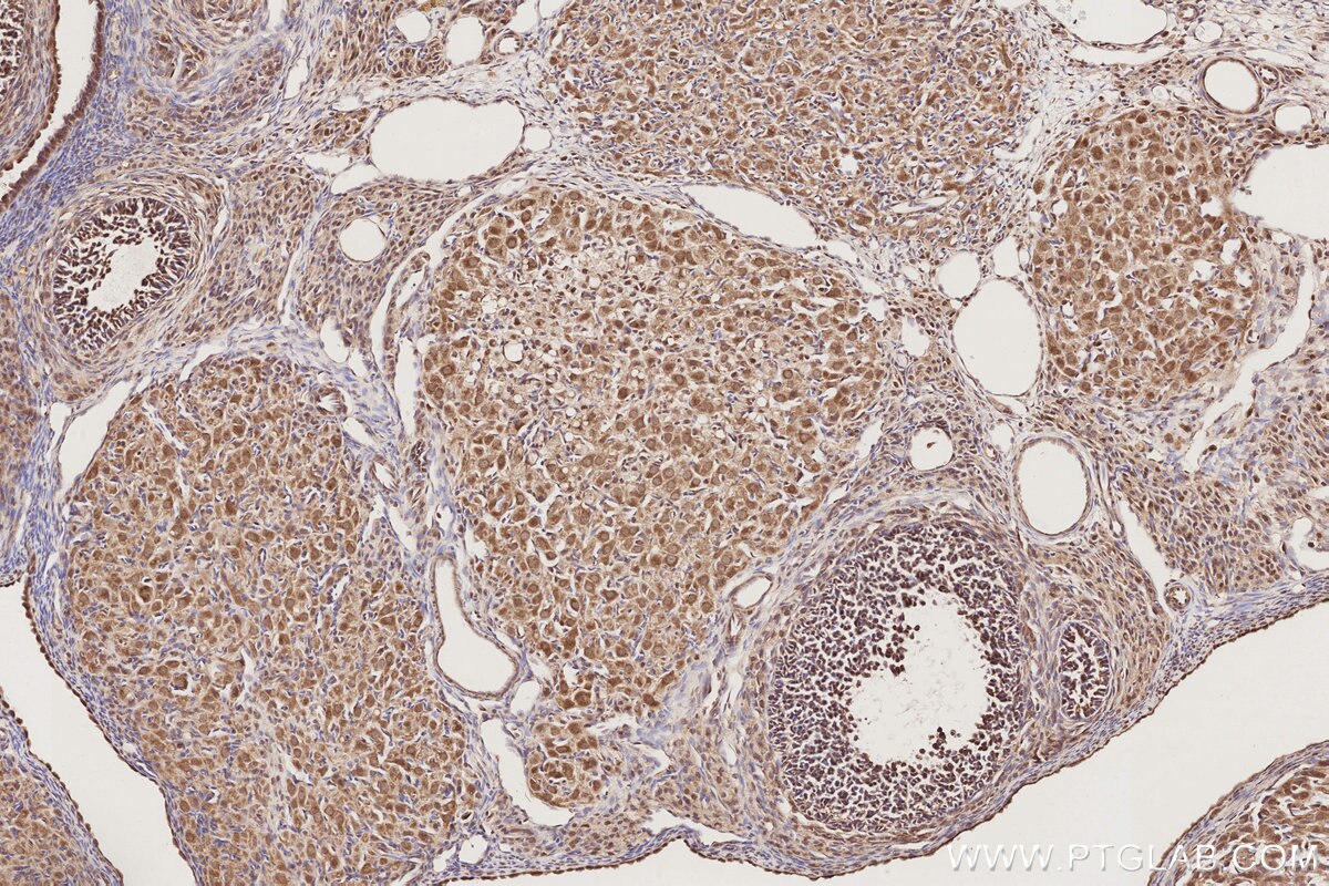 IHC staining of rat ovary using 19820-1-AP Immunohistochemistry (IHC) staining of rat ovary tissue using MIS12 Polyclonal antibody (19820-1-AP)