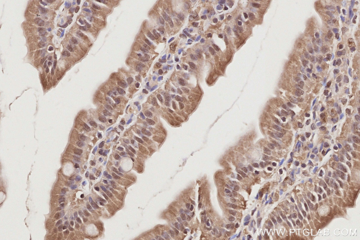 IHC staining of rat small intestine using 19820-1-AP Immunohistochemistry (IHC) staining of rat small intestine tissue using MIS12 Polyclonal antibody (19820-1-AP)