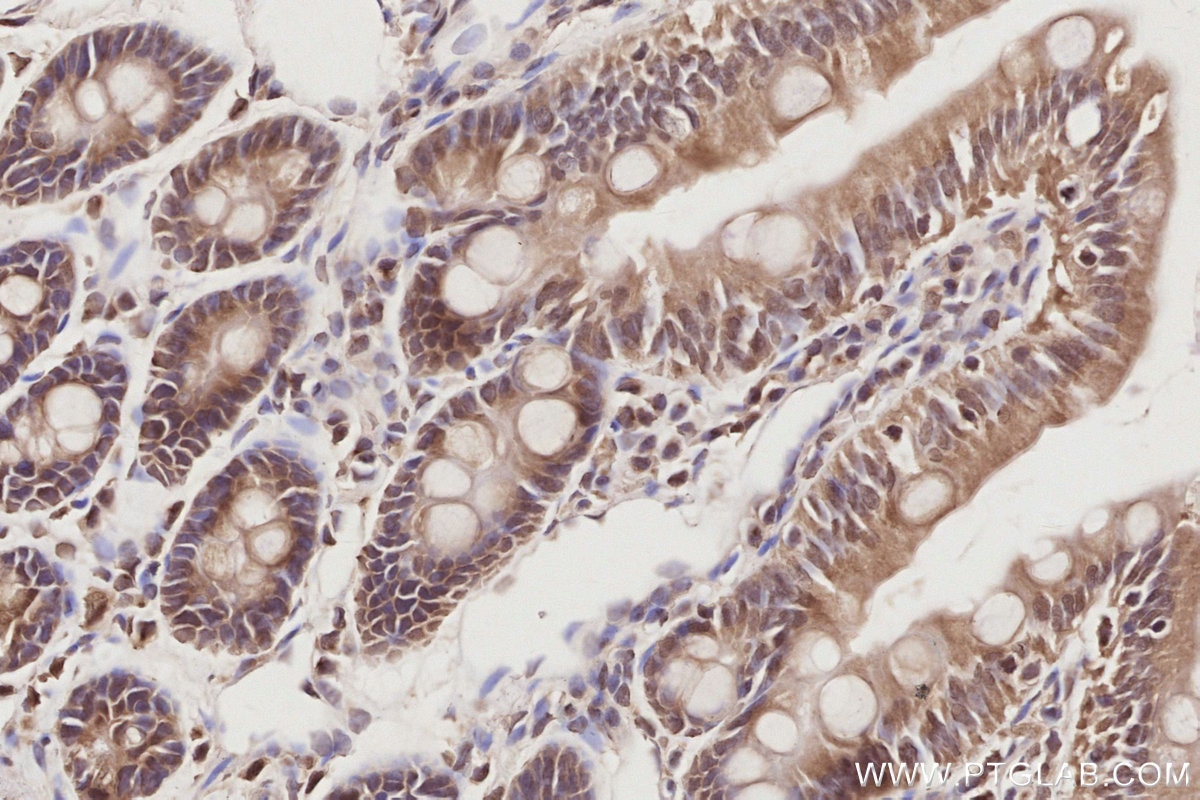 IHC staining of rat small intestine using 19820-1-AP Immunohistochemistry (IHC) staining of rat small intestine tissue using MIS12 Polyclonal antibody (19820-1-AP)