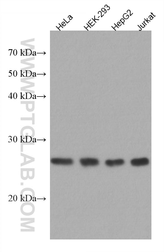 Western Blot (WB) analysis of various lysates using MIS12 Monoclonal antibody (67475-1-Ig)