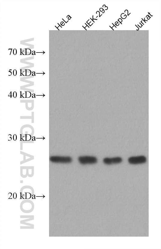 WB analysis using 67475-1-Ig