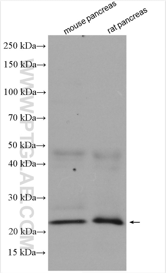 Western Blot (WB) analysis of various lysates using MIST1 Polyclonal antibody (29853-1-AP)